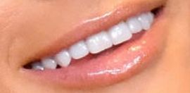 Picture of Paris Hilton teeth and smile