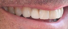 Picture of Patrick Dempsey teeth and smile