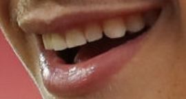 Patrick Mahomes' teeth