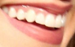 Picture of Perry Mattfeld teeth and smile