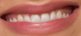 Picture of Perry Mattfeld teeth and smile