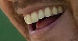 Picture of Peter Weber teeth and smile