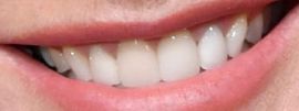 Picture of Portia de Rossi teeth and smile