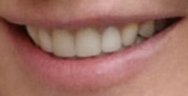 Picture of Portia de Rossi teeth and smile