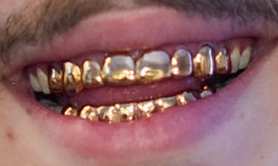 Post Malone's teeth and smile