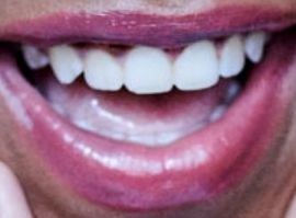 Picture of Priah Ferguson teeth and smile