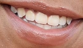 Picture of Priah Ferguson teeth and smile