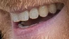 Picture of Prince Harry's teeth and smile