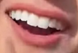 Picture of Priscilla Block teeth and smile