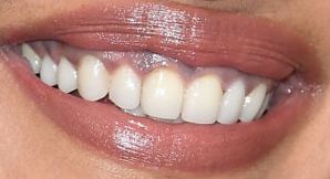 Picture of Priyanka Chopra teeth and smile
