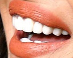 Picture of Priyanka Chopra teeth and smile