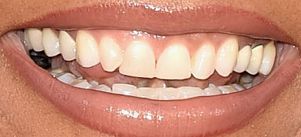 Picture of Queen Latifah teeth and smile