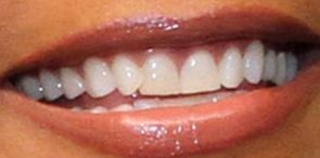 Picture of Queen Latifah teeth and smile