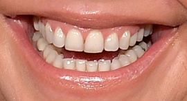 Picture of Rachael Ray teeth and smile