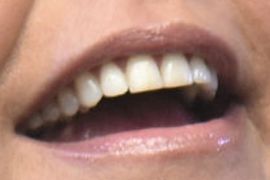 Picture of Rachael Ray teeth and smile