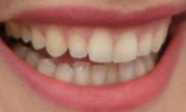 Picture of Olivia Wilde teeth and smile