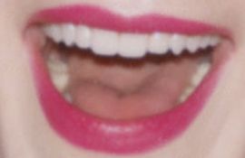 Picture of Rachel Brosnahan teeth and smile