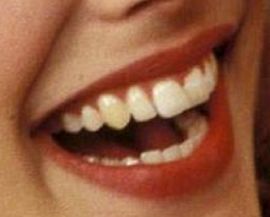 Picture of Rachel McAdams teeth and smile
