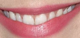 Picture of Rachel McAdams teeth and smile