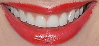Picture of Rachel Skarsten teeth and smile