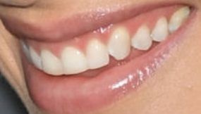 Picture of Rachel Skarsten teeth and smile