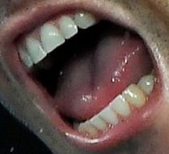 Rafael Nadal teeth