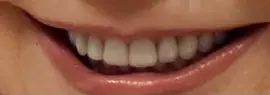 Picture of Reba McEntire teeth and smile