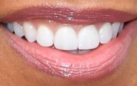 Picture of Regina King teeth and smile
