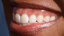 Picture of Regina King teeth and smile