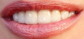 Picture of Rhea Durham's teeth and world while smiling