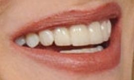 Picture of Rhea Durham's teeth and world while smiling