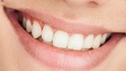 Picture of Rhys Matthew Bond teeth and smile
