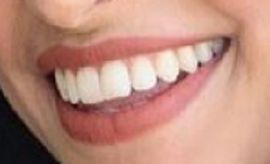 Picture of Richa Moorjani teeth and smile