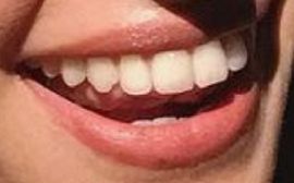Picture of Richa Moorjani teeth and smile