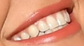 Picture of Rita Ora teeth and smile