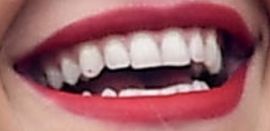 Picture of Rita Ora teeth and smile