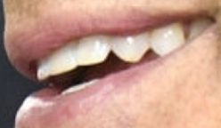 Picture of Rob Lowe teeth and smile