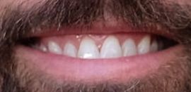 Picture of Rob McElhenney teeth and smile