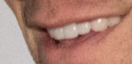 Picture of Robert Buckley teeth and smile