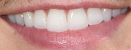Picture of Robert Scott Wilson teeth and smile