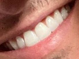 Picture of Robert Scott Wilson teeth and smile