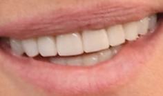 Picture of Robin Wright teeth and smile