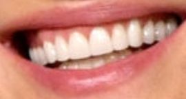 Picture of Robin Wright teeth and smile