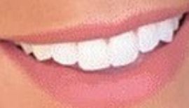 Picture of Robyn Dixon teeth and smile
