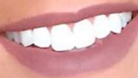 Picture of Robyn Dixon teeth and smile