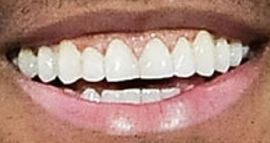 Picture of Romeo Santos teeth and smile