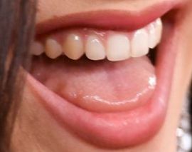 Picture of Rosalia teeth and smile