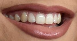 Picture of Rosalia teeth and smile
