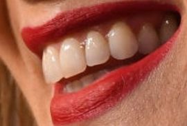 Picture of Rosamund Pike teeth and smile