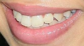 Picture of Ruth Righi teeth and smile